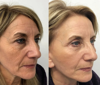 Elesse Cream crema anti-riduri cearcane pete